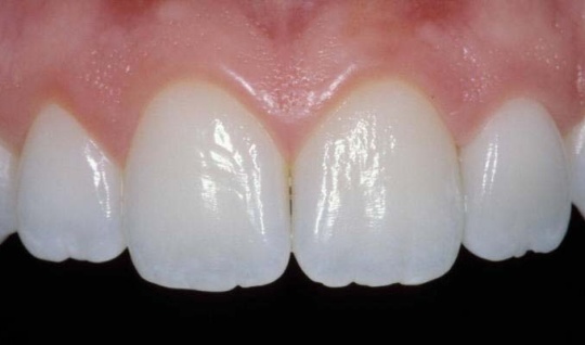 A close up image of teeth